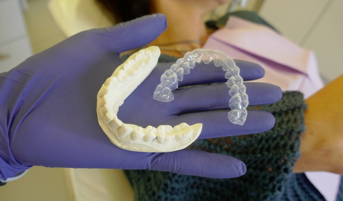 Custom-fit teeth whitening trays moulded by Kelly Smith, RDH at Kurly's Pearlies in Georgetown, Ontario